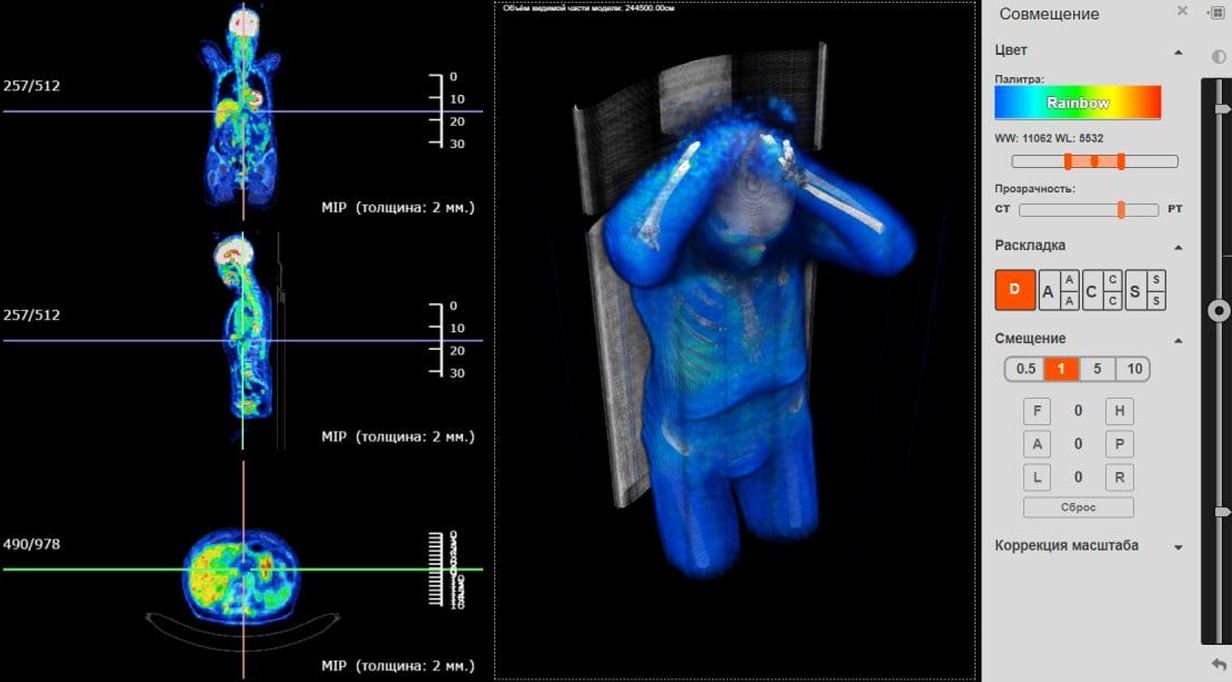 Advanced Tools for Multimodal Image Analysis