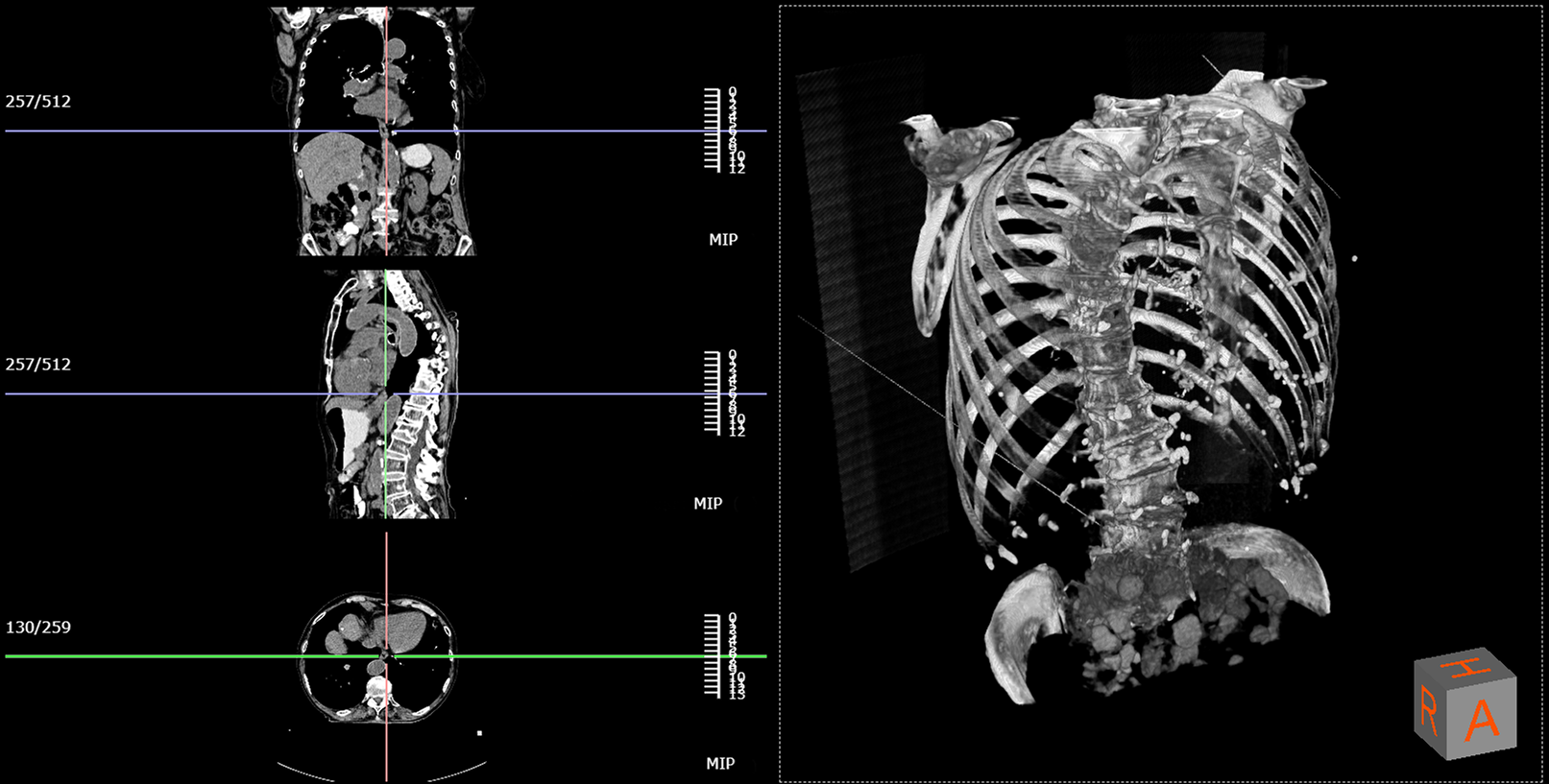 Accessible, Efficient, and Scalable