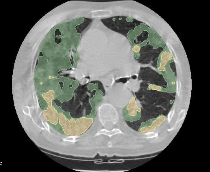 Efficiency Meets Accuracy
